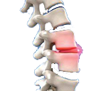 xf_spine